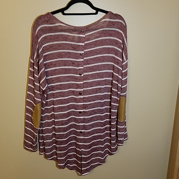 Striped tunic - Picture 2 of 5
